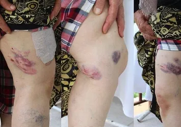 Yaşlı kadın çeşmeden su doldurup evine dönerken dehşeti yaşadı: Üzerime hücum edip kıyafetimi yırttılar