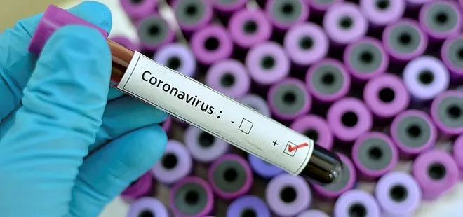 Son dakika: Dünya Sağlık Örgütü’nden korkutan ’koronavirüs’ açıklaması: Hazırlıklı olun
