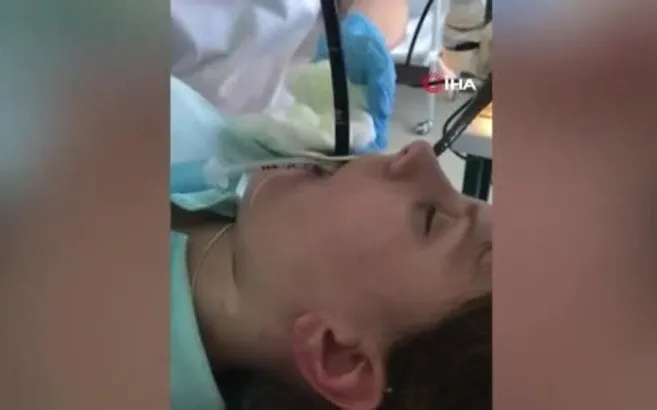 kadinin midesinden 1 metre boyunda yilan cikarildi