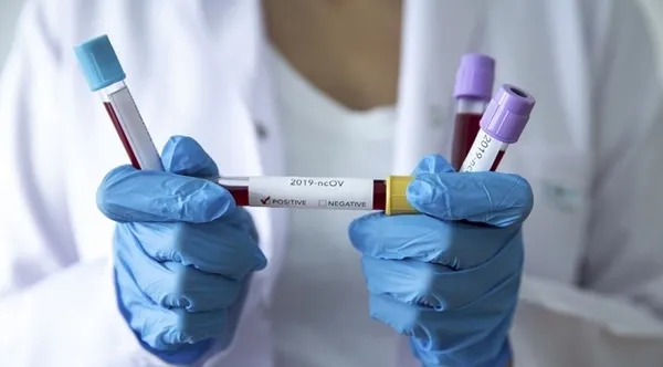 Bilim insanları araştırıyor! Koronavirüse benzer yeni bir virüs bulundu