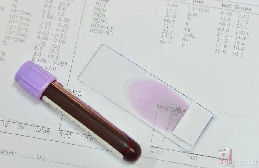 Hangi kan grubu nasıl beslenmeli? İşte kan grubunuza göre tüketmeniz gereken besinler... 14