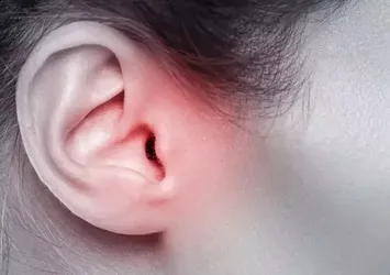 Orta kulak iltihabı tedavi edilmezse yüz felci yapabiliyor!