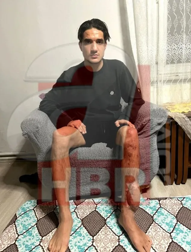 chpli-tutuncu-yine-fena-yakalandi-a-haber-tek-tek-yalanlarin-belgesini-acikliyor-1767542698338.jpg CHP Üsküdar İlçe Başkanı’nın kendisine çarpması sonucu 8 ameliyat geçiren Hacı Resul Düzgün, ilk kez ahaber.com.tr’ye konuştu.