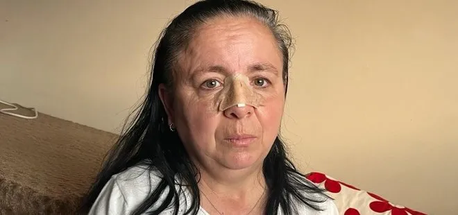 Eskişehir’de kocası tarafından şiddet gören kadının yardım çığlığı: Ölmek istemiyorum