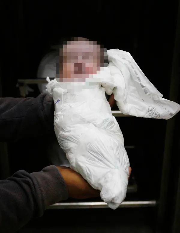1698824094325.jpg Gazze'de insanlık suçu! Katili İsrail bir yaşını doldurmamış 133 bebeği öldürdü! Filistinli kadınların çaresizliği: Fener ışığında anestezisiz sezaryan doğum - 2