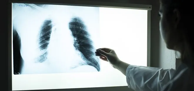 KOAH’ta erken tanı hayat kurtarıyor