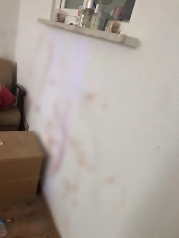 Sahte içki Bursa'dan sonra İstanbul'da da can aldı! Elleri ve yüzü kan içindeydi - 3