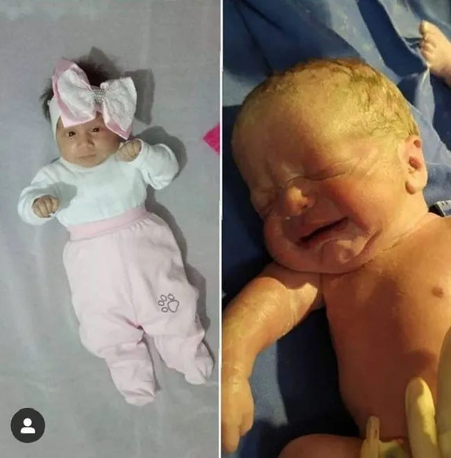 İkizlerinden birini SMA'dan kaybeden acılı aile: Ne olur Eylül yaşasın - 2