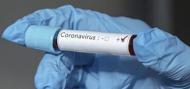 İstanbul’da yapılan operasyonda 5 bin 575 adet koronavirüs tanı kiti ele geçirildi