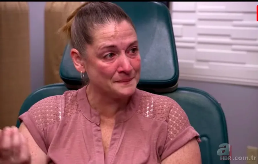 Bilim insanları şaşkın! Kafasında boynuz çıktı... 4