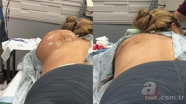 30 yıl boyunca baş ağrısıyla yaşadı! Nedeni şoke etti... 142