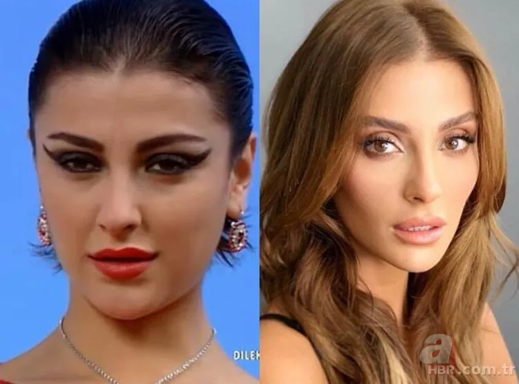 Seda Sayan'ın son hali şaşkına çevirdi! Estetik sonrası... 25