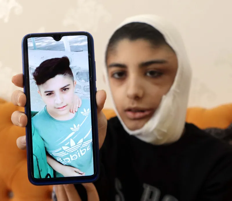Çenesinin altına kadar indi! Yüzündeki yara her geçen gün büyüyor