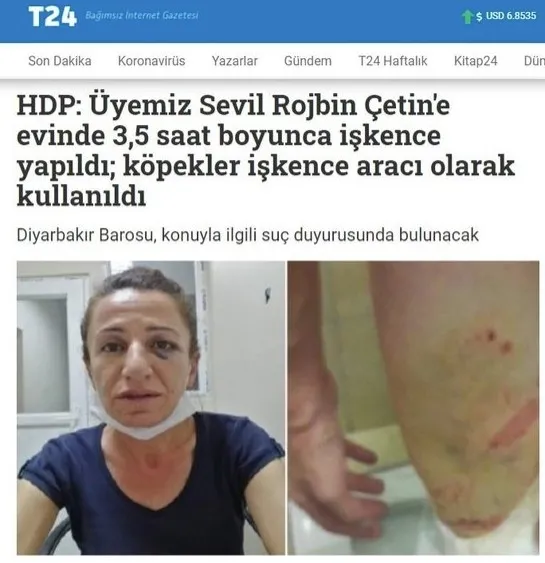 Diyarbakır Valiliği köpekle işkence iddiasını yalanladı
