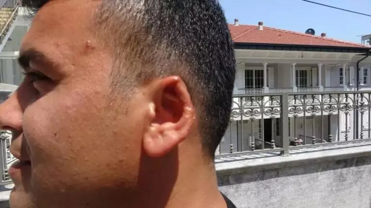 Kavga esnasında kulağını ısırıp koparmıştı! Cezası belli oldu