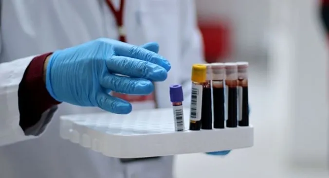 Kızılay Başkanı Dr. Kerem Kınık plazmalardan "pasif aşı" üreteceklerini duyurdu - 2