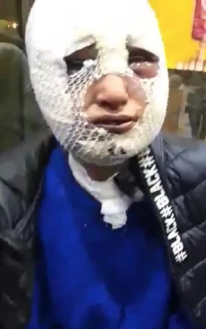 eski-sozlusunu-darp-etti-tecavuz-etti-basindan-asagi-kizgin-yag-doktu-serbest-birakildi-1646830753888.jpg Eski sözlüsünü darp etti, tecavüz etti, başından aşağı kızgın yağ döktü: Serbest bırakıldı - 4