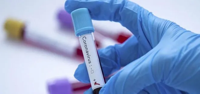 ABD’den koronavirüs açıklaması: 4 hastadan biri belirtileri göstermiyor