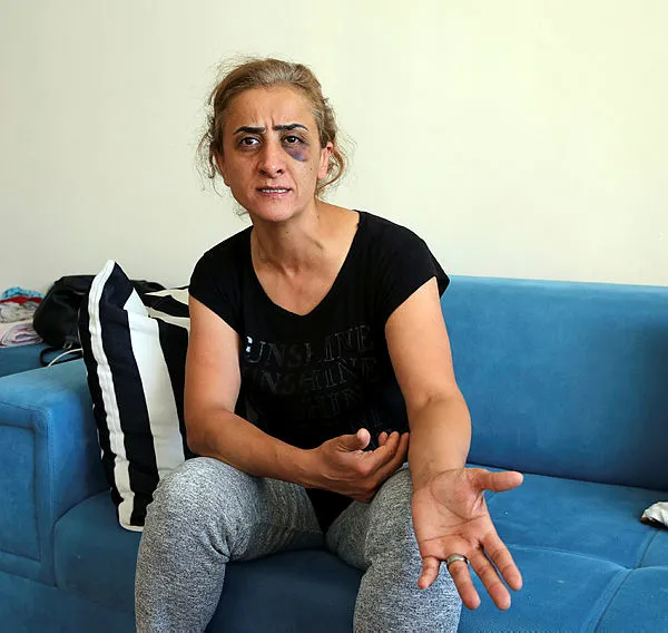 antalyada-yasayan-dilek-goktasin-yardim-cigligi-hayatim-kabus-oldu-olmek-istemiyorum-1623130825762.jpg Antalya’da yaşayan Dilek Göktaş’ın yardım çığlığı: Hayatım kâbus oldu ölmek istemiyorum - 3
