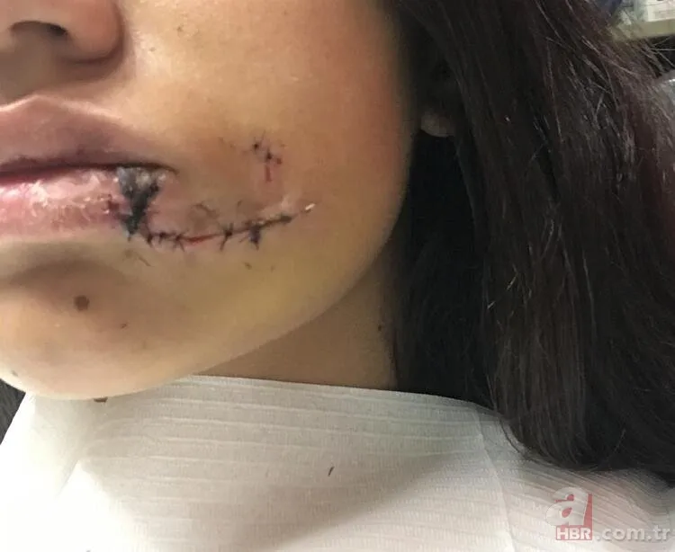 Köylüler ellerinde sopayla geziyor! Katil kuş özellikle sarışın kadınlara saldırıyor 17