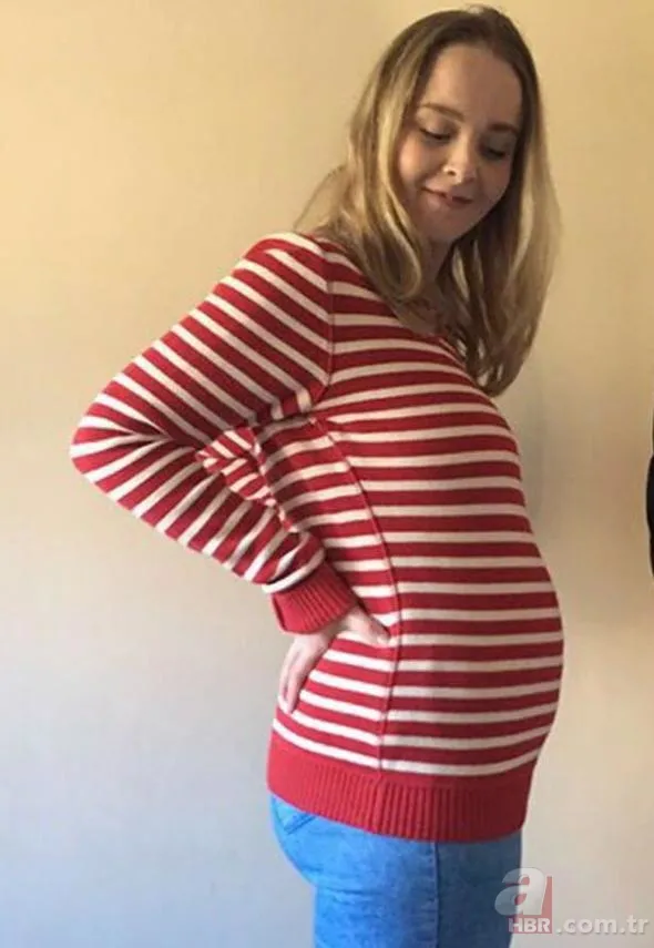 Doktorlar bile hamile sandı! Çıkanlara kimse inanamadı... 2