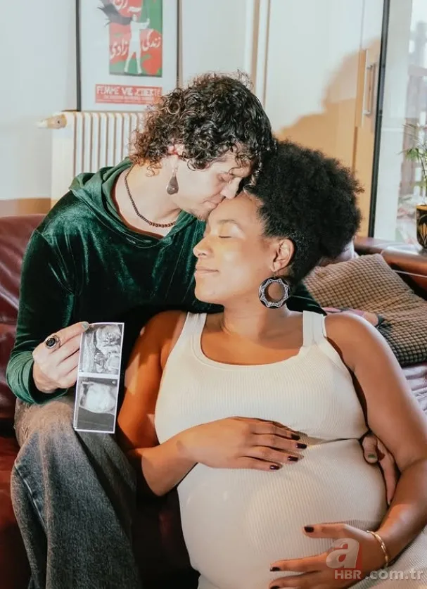 O Ses Türkiye şampiyonu Emre Sertkaya'nın son halini gören şaşkına döndü 3