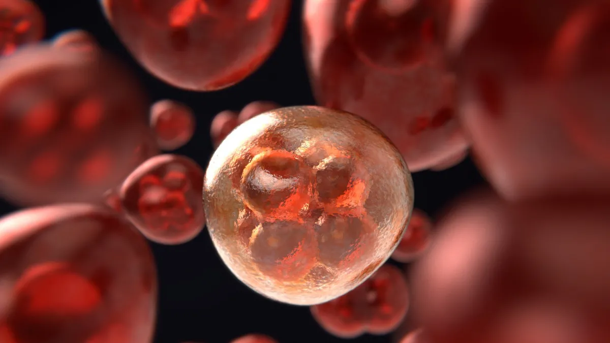 Kolon kanseri nedir? Kalın bağırsak kanseri belirtileri...