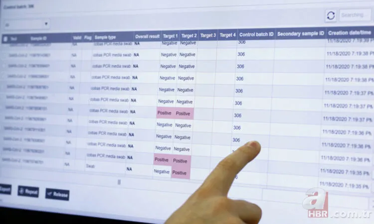 Uzmanlar 'Teşhis için çok önemli' deyip uyardı: Yüzde 60'ı pozitif! Elon Musk’ın sözleriyle yeniden gündeme geldi 17