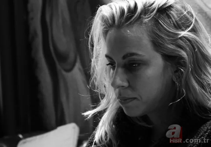 Amasya’daki kazada ölümden dönen Uraz Kaygılaroğlu’nun eski eşi Melis İşiten tepkilerin ardından paylaştı! Kolundaki dikkat çeken ayrıntı… 5