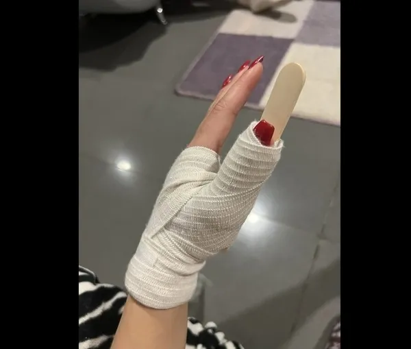 1686042459416.jpg Dişlerini kırıp duvardan itmişlerdi! İlk kez A Habere’e konuştu | Türk kıza ırkçı saldırıda yeni gelişme - 3