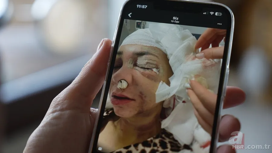 Anne ve oğlunu öldüresiye dövüp 'merdivenden düştü' dediler: Meğer ilk vukuatları değilmiş 4