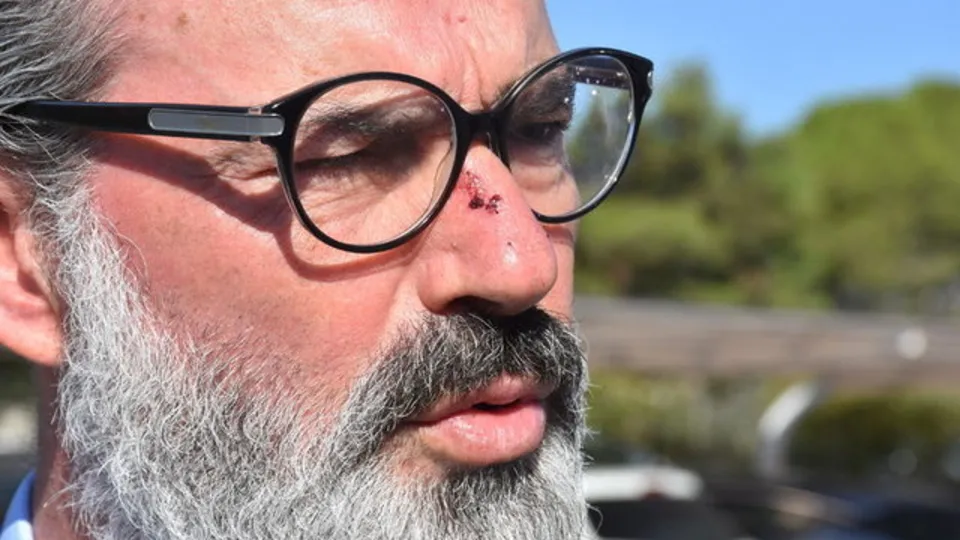 Murat Başoğlu 'Cehennemde yanacaksın' diyen takipçisine küfür etti