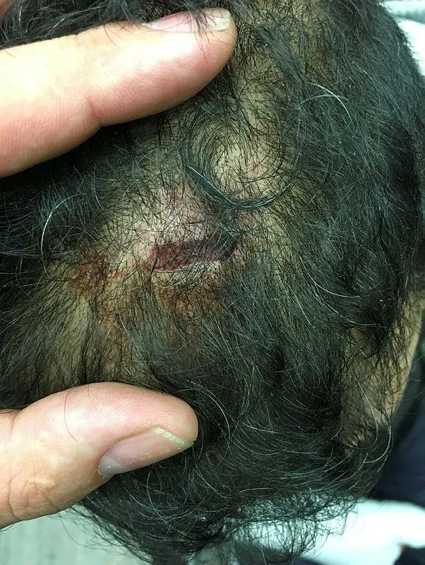 Alman polisi bir Türk’e işkence edip sokağa attı