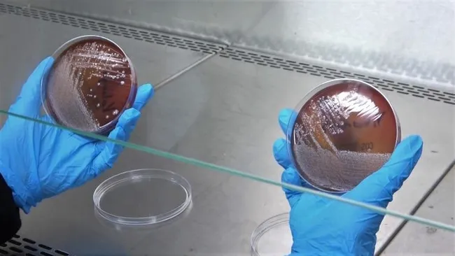 Samsun’da test edildi! Maskeye kolonya sıkma veya yıkama bakteri oluşumunu engellemiyor