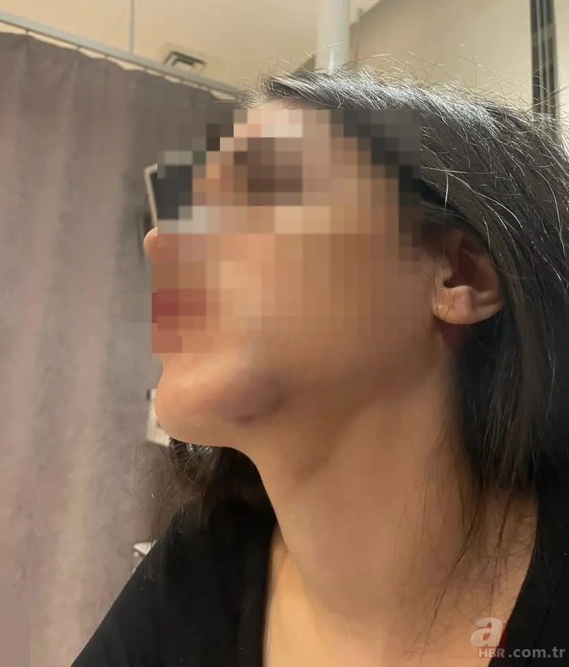 “Konuşacağız” deyip tuzak kurdu: Genç kadın dehşeti yaşadı 5