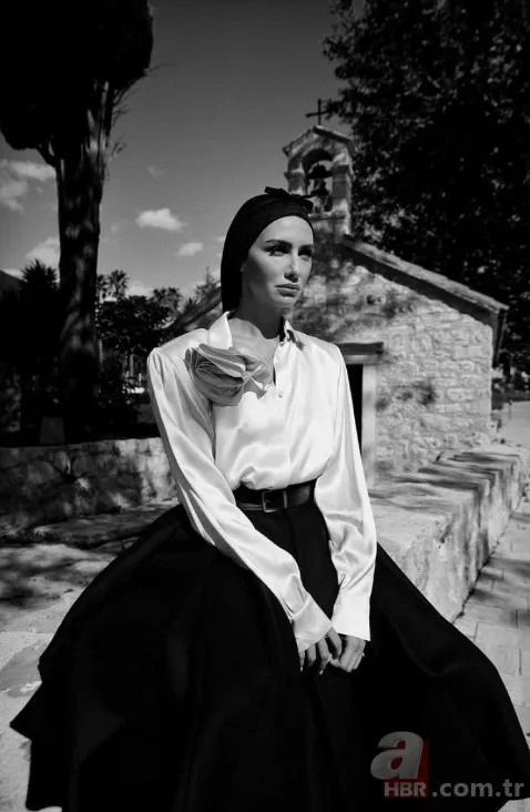 Kuş Uçuşu’nun Lale’si Birce Akalay değişimiyle şoke etti! Estetik harikası çıktı! Boneli pozlarıyla gündeme oturan Birce Akalay’ın estetiksiz hali 5