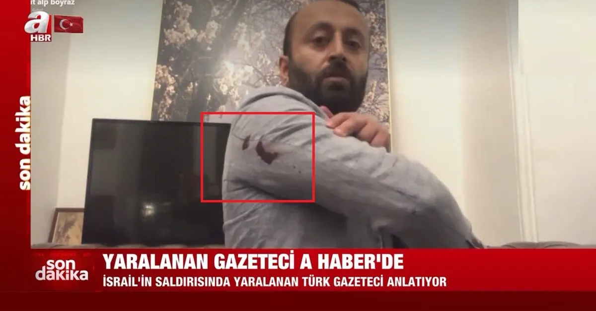 İsrail güçlerinin saldırısında yaralanan Türk gazeteci A Haber'e konuştu