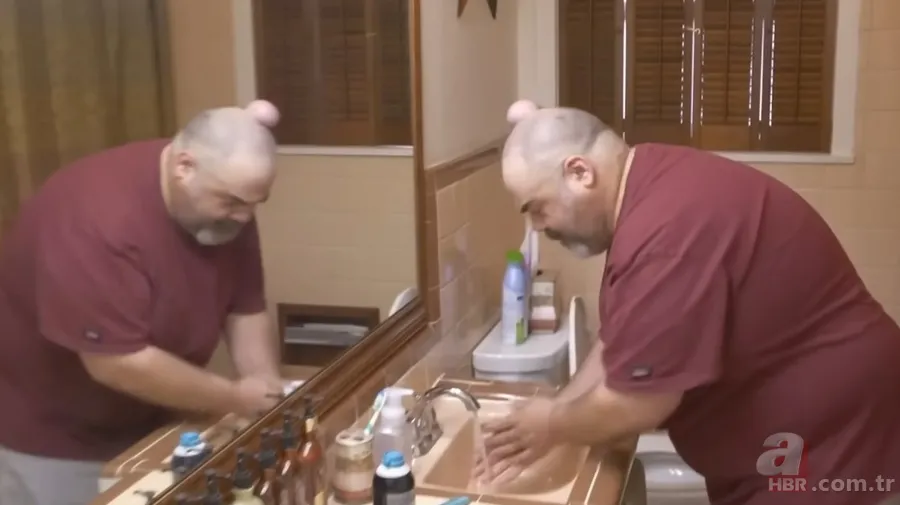 Sokağa şapka ile çıkıyordu! Başındaki şişlikten bakın ne çıktı 👩⚕️ Görenleri şaşkına çeviren olay 16