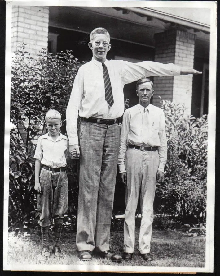 En uzun boylu insan: Robert Wadlow