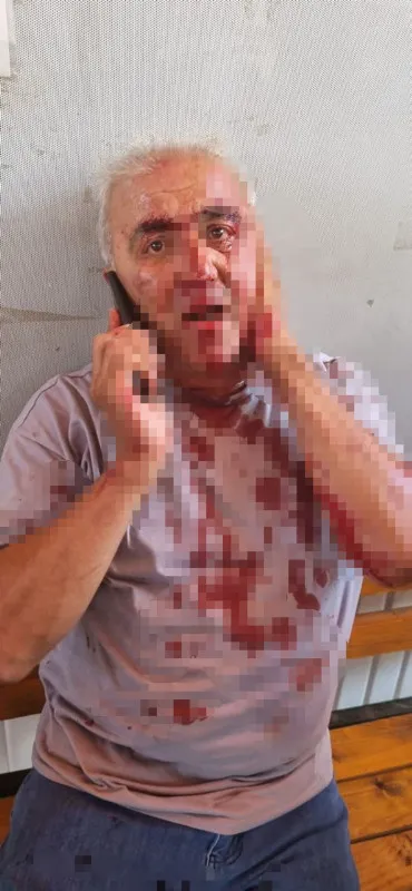 Minibüs parasını isteyen şoför kulağından oldu! Cani yolcu zavallı adamı dişleriyle parçaladı - 2