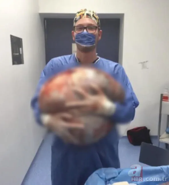 Doktorlar bile hamile sandı! Çıkanlara kimse inanamadı... 10