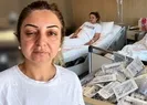 Sahte botoks bu hale getirdi: Çift görüyorum