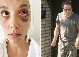 Ozan Güven tarafından darbedilen Deniz Bulutsuz’un fotoğrafı dehşete düşürdü!