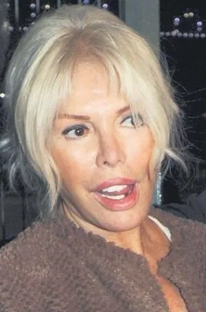 Ajda Pekkan In Disleri Dokuldu A Haber Son Dakika Magazin Haberleri