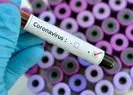 Kan grubu “A” olanların, koronavirüse yakalanma riski daha fazla