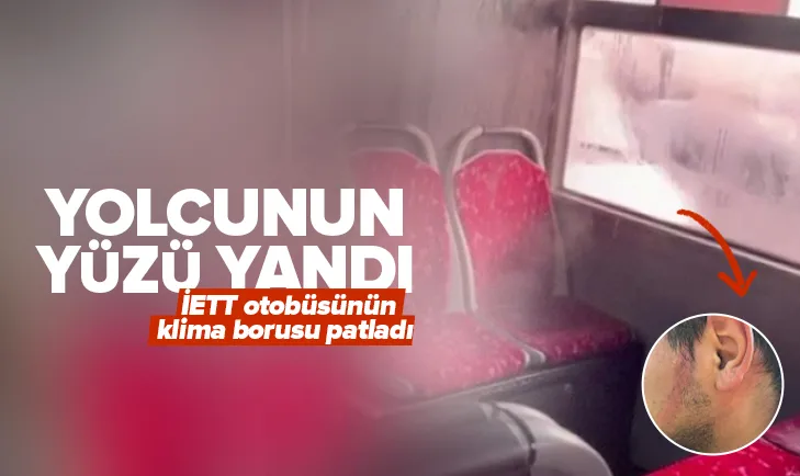 Akıllara durgunluk veren talihsizlik! Ümraniye’de İETT otobüsünün klima borusu patladı, yolcunun yüzü yandı