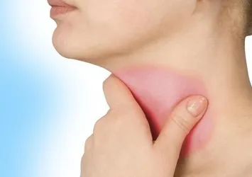 Bademcik iltihabına bunları yapın