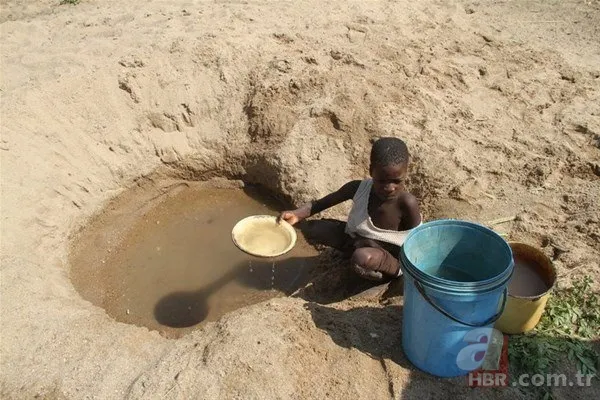 Dünyanın en tuhaf hastalıkları 16