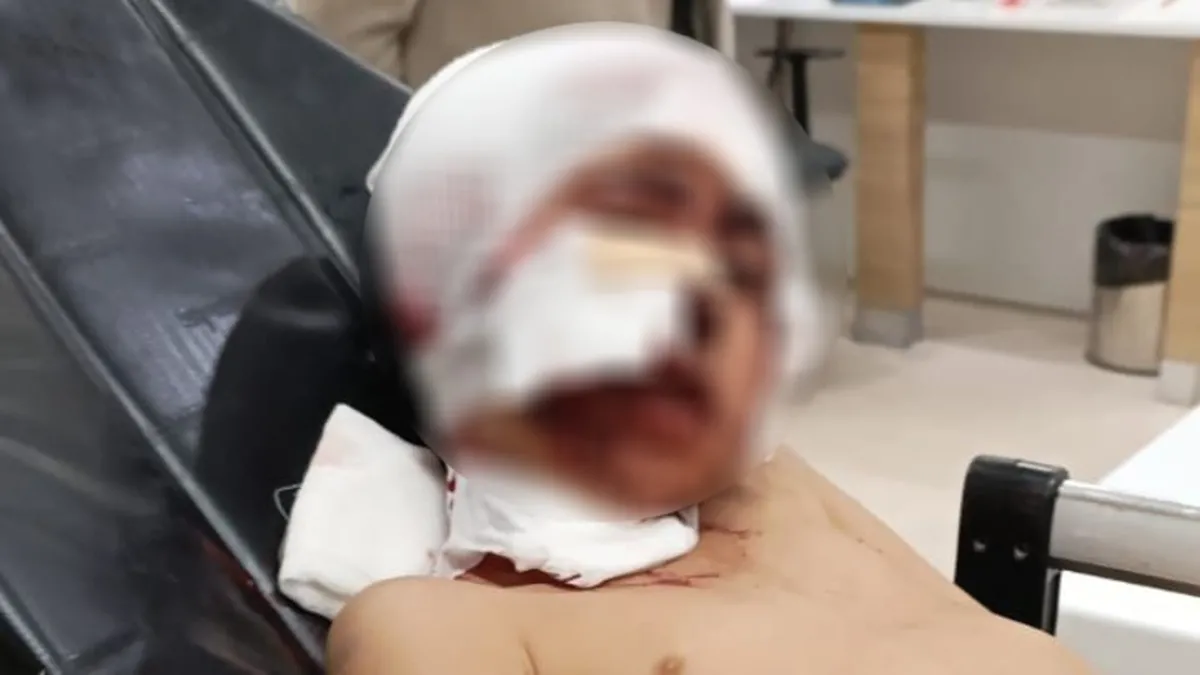 Erzurum'da sokak köpeği dehşeti! Bakan Tunç duyurdu: Soruşturma başlatıldı