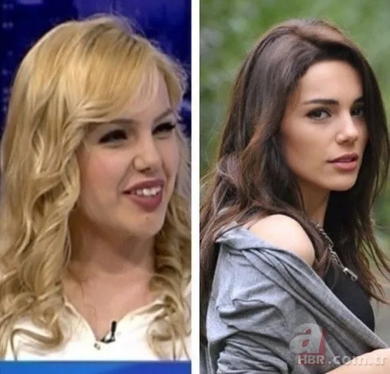 Bir Zamanlar Çukurova’nın Gülten’i Selin Genç de estetik harikası çıktı! Eski hali şoke etti 10